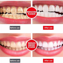 Sp-4 Ultra Teeth Whitening Toothpaste
